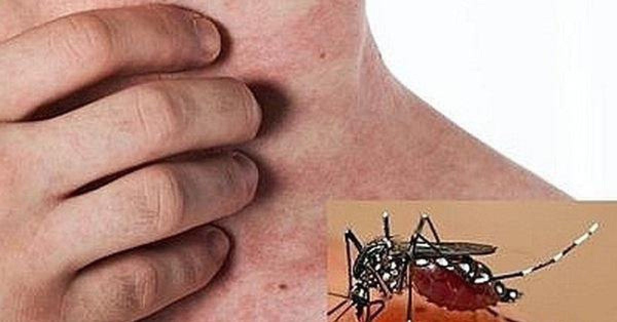 Sức khỏe đời sống - Từ trường hợp vừa tử vong do sốt xuất huyết ở Hà Nội, cần loại bỏ ngay những sai lầm “chết người” nếu không muốn nguy hiểm