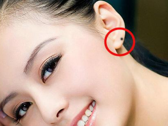 Bạn trẻ - Cuộc sống - Vị trí 3 nốt ruồi thịnh vượng, ai có được thì cuộc đời giàu sang, may mắn