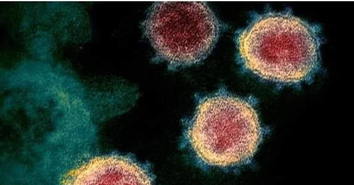 Sức khỏe đời sống - Phát hiện mới: Virus SARS-CoV-2 có thể xâm nhập vào não người