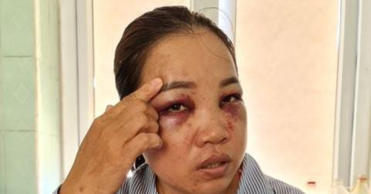 Pháp luật - Người đàn bà bị chồng cũ tìm đến tận nhà đánh đập dã man