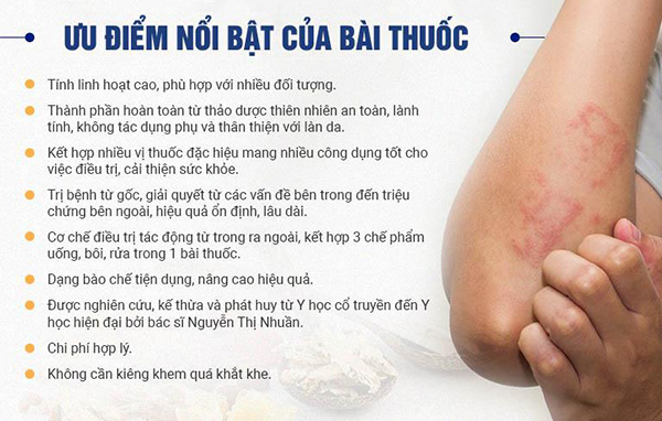 Bài thuốc của phòng chẩn trị Y học cổ truyền Đông y Việt Nam sở hữu nhiều ưu điểm mà bài thuốc khác không có