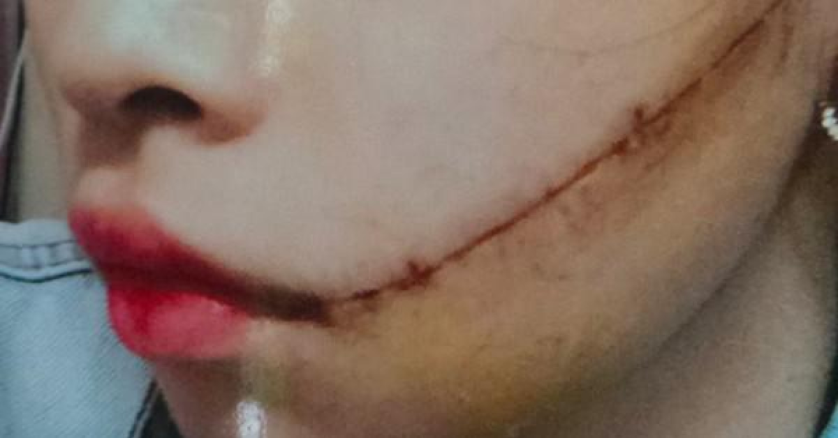 Pháp luật - Nhẫn tâm rạch mặt "vợ hờ" từ câu thách thức