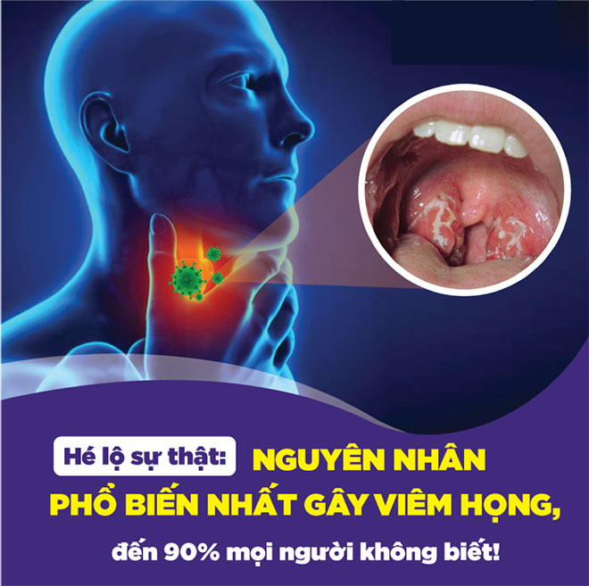 Vừa chớm ho, đau rát cổ dùng ngay thứ này đỡ ngay - 1