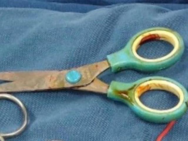 Sức khỏe đời sống - Bé trai 7 tuổi nhập viện với chiếc kéo cắt giấy đâm xuyên cổ