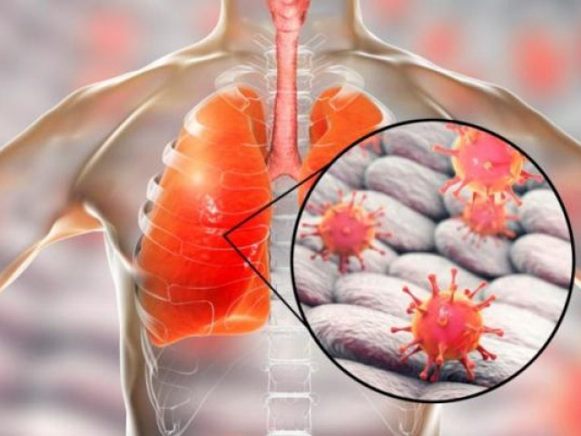 Sức khỏe đời sống - 5 căn bệnh gây tử vong cao nhất và cách phòng chống