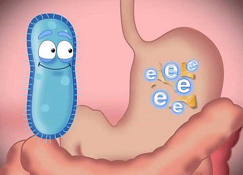 Viêm đại tràng – Nguyên nhân, triệu chứng và cách xử lý hiệu quả - 3