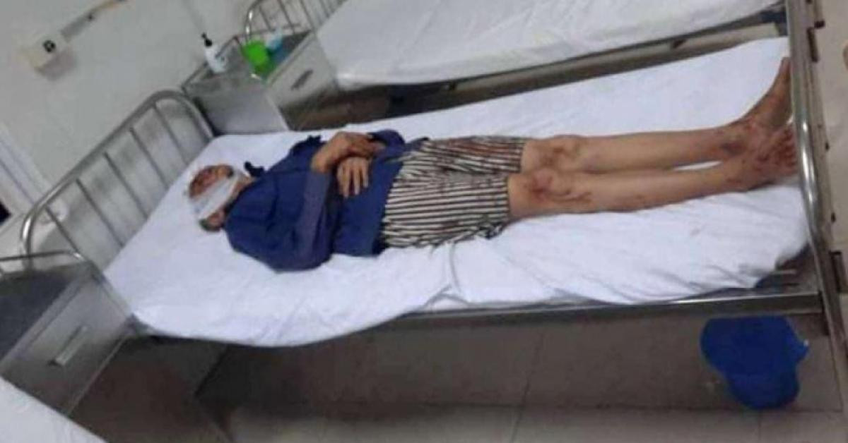 Pháp luật - Đi ăn đám giỗ về, con rể dùng rựa chém cha vợ và anh vợ trọng thương