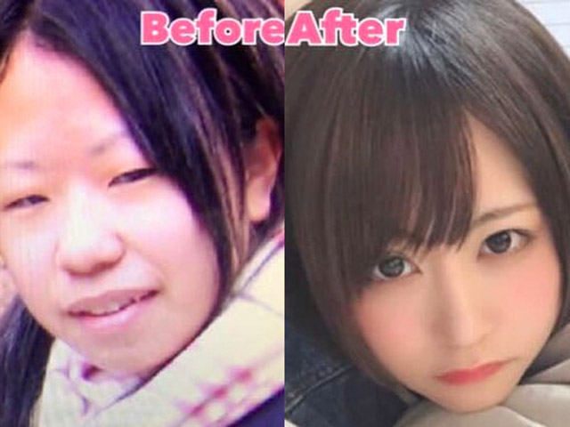 Bạn trẻ - Cuộc sống - Từng trầm cảm vì xấu xí, cô gái chi gần 1 tỷ đồng biến "vịt thành thiên nga"