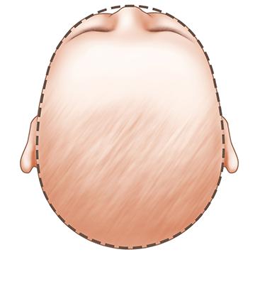 Hình dạng đầu trẻ bình thường 