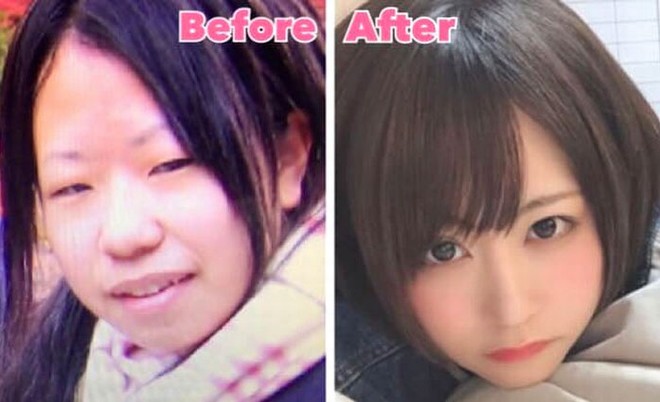 Nhan sắc trước và sau khi thay đổi ngoại hình của cô gái trẻ.