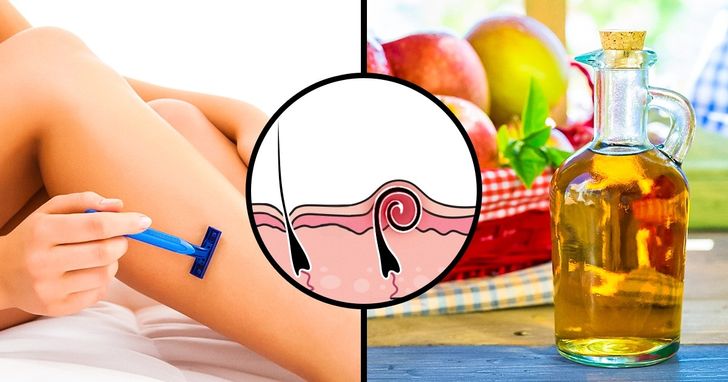 Những cách giúp chàng và nàng &#34;sạch cỏ&#34; lại có da mịn màng mùa hè này - 5