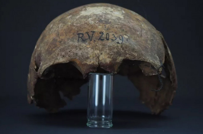Hộp sọ người đàn ông 5.000 tuổi chết vì vết cắn của hải ly - Ảnh: Đại học Kiel