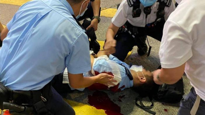 Viên sỹ quan cảnh sát Hồng Kông bị đâm được đồng đội sơ cứu - ảnh SCMP.