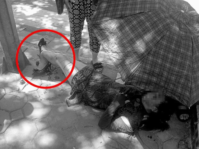 Tin tức trong ngày - Hà Nội: Kinh hãi áo chống nắng cuốn vào bánh xe, người phụ nữ gãy gập cổ chân