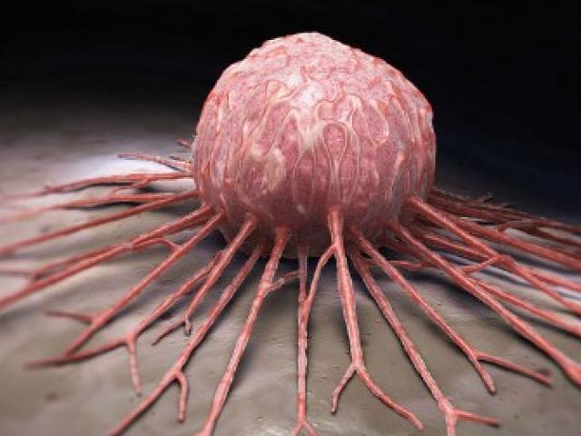 Sức khỏe đời sống - Người trên 45 tuổi hãy tránh xa 4 loại thực phẩm này để giảm nguy cơ ung thư