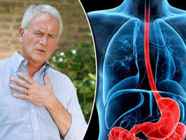 Sức khỏe đời sống - Đầy bụng, khó tiêu, buồn nôn, ợ chua nhiều, 1000 ngày vật vã vì trào ngược của tôi đã là dĩ vãng