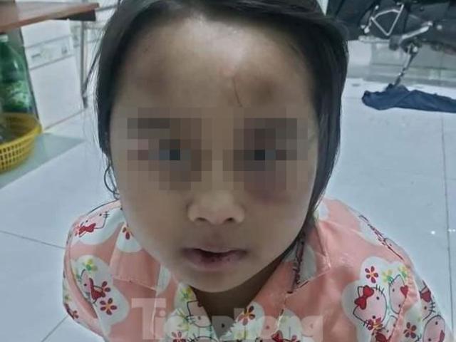 Pháp luật - Cha về quê, con bị cô và dượng đánh đập tàn bạo