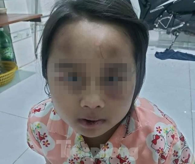 Cha về quê, con bị cô và dượng đánh đập tàn bạo - 3