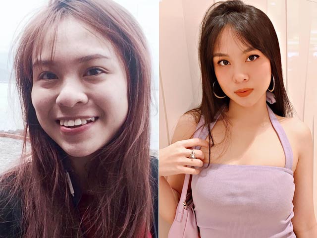 Bạn trẻ - Cuộc sống - Bị người yêu bỏ, cô gái nhổ 8 chiếc răng làm đẹp để trả thù và cái kết