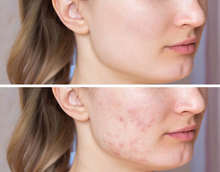 Vì sao bạn không nên dùng vòi sen rửa mặt khi tắm - 1