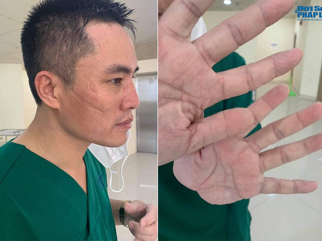 Bạn trẻ - Cuộc sống - Nghẹn ngào bài thơ nghĩa tình của nam điều dưỡng trên tuyến đầu chống dịch COVID-19