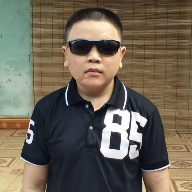 34 tuổi, nhưng di chứng của vụ nổ khiến Thơ mù, điếc, bé như một học sinh tiểu học và ốm yếu quanh năm
