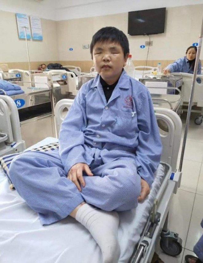 Ảnh hưởng bởi vụ nổ, Thơ thường xuyên phải vào viện điều trị (Trong ảnh: Nguyễn Văn Thơ trong lần điều trị tại Bệnh viện Tai - Mũi - Họng, tháng 6/2021)