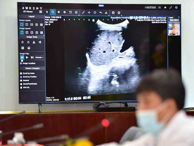 Công nghệ thông tin - COVID-19: Hơn 1.800 bệnh nhân nặng đã được hội chẩn online qua Telehealth