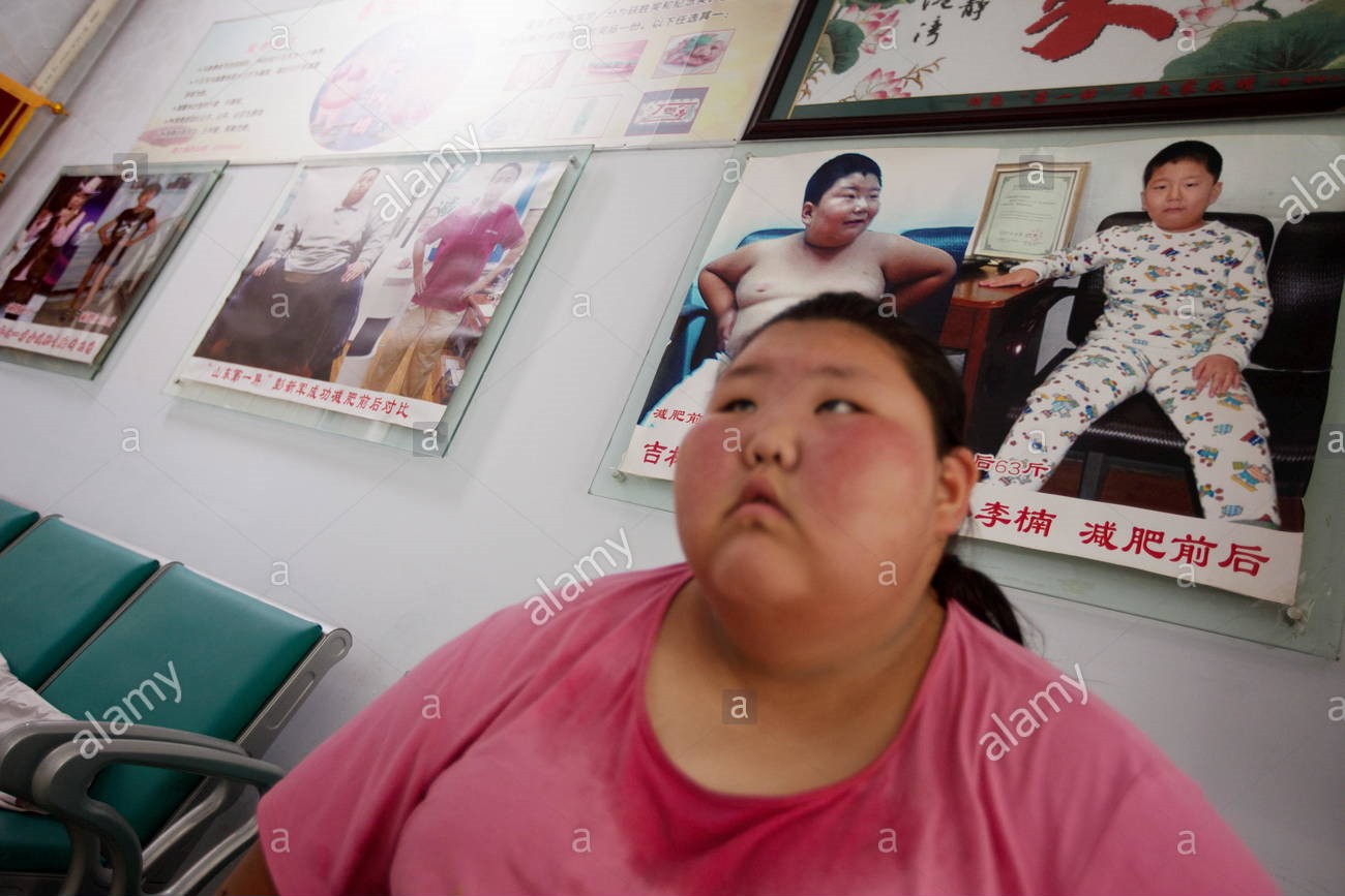 Thiếu nữ Trung Quốc 16 tuổi nặng hơn 82kg.