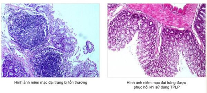 Tràng Phục Linh PLUS có thực sự hiệu quả cho người bị đại tràng lâu năm? - 5