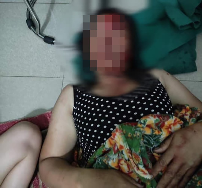 Bà H, tố bị chồng gây thương tích - Ảnh: NVCC