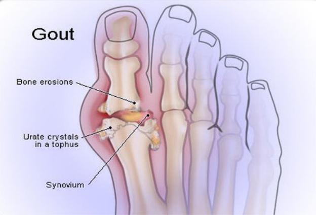 Uống quá nhiều rượu là "tích luỹ" ít nhất 10 căn bệnh nguy hiểm - 9