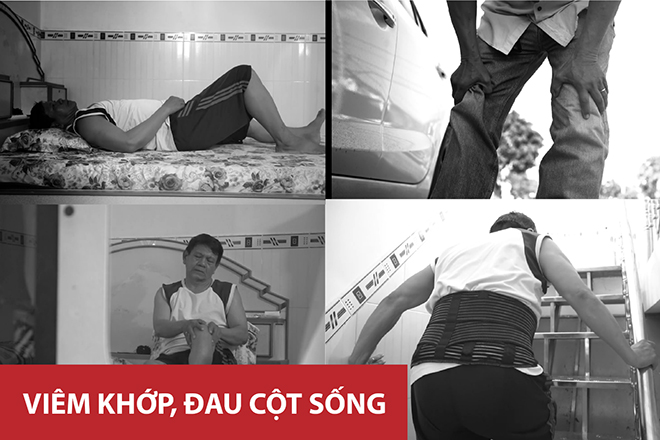 Lạm dụng thuốc giảm đau điều trị viêm khớp, thoái hóa khớp - Hậu quả khôn lường! - 2