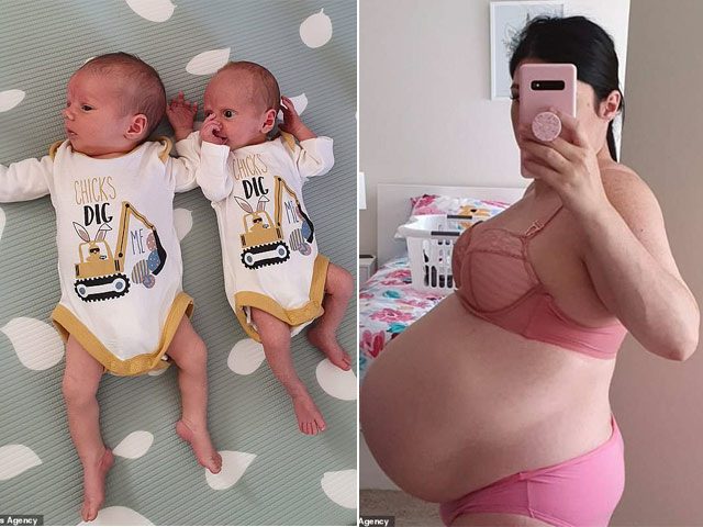 Bạn trẻ - Cuộc sống - Kỳ lạ với cặp song sinh đẻ cách nhau vài ngày