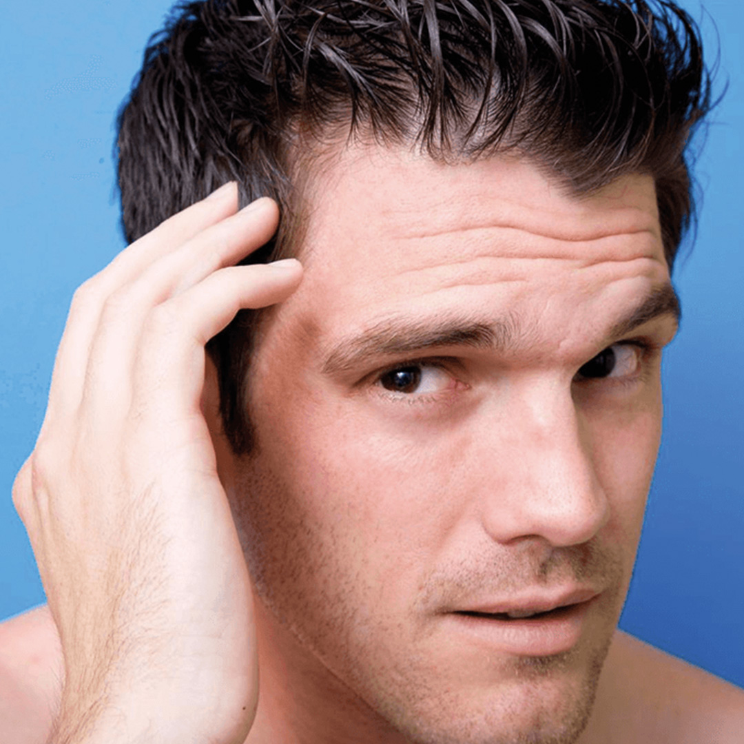 Nước ép hành, gừng giúp chàng hói mọc tóc nhanh - 1