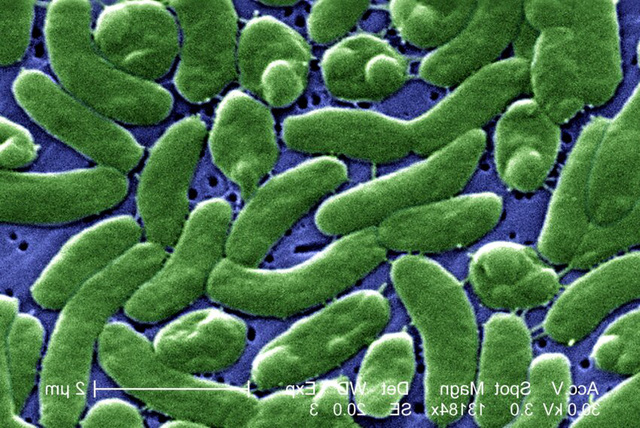 Vi khuẩn Vibrio vulnificus dưới kính hiển vi