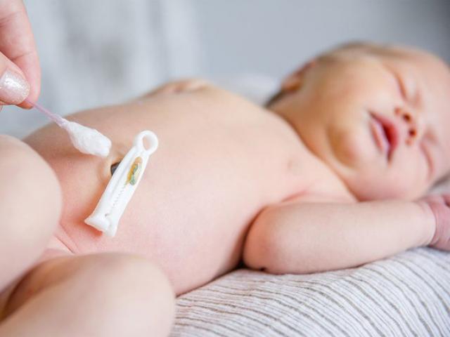 Sức khỏe đời sống - Nếu rốn của bé cưng có những biểu hiện này, cha mẹ nên đưa con đến gặp bác sỹ sớm