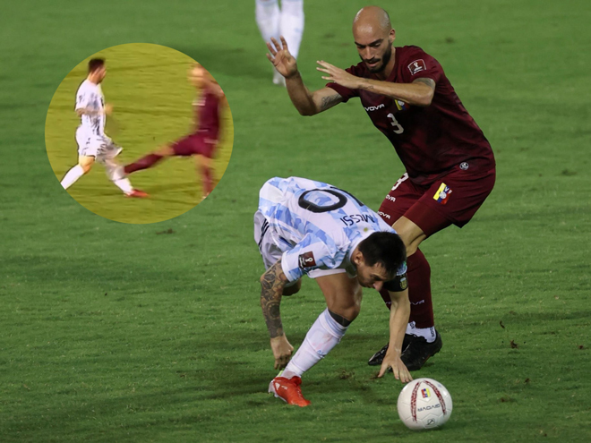 Messi bị các cầu thủ Venezuela phạm lỗi rất nhiều và suýt gãy chân