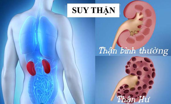 7 thói quen gây hại thận khủng khiếp, chuyên gia khuyến cáo nên từ bỏ ngay hôm nay - 1