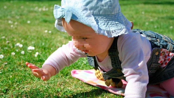 Một tuần sau ca phẫu thuật, tình hình sức khỏe bé gái 9 tháng tuổi đã ổn định, được bác sĩ cho ra viện. Ảnh minh họa