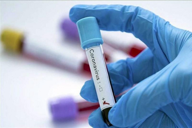 Lạc quan với cuộc đua bào chế thuốc trị COVID-19. Ảnh: MEDIALAB