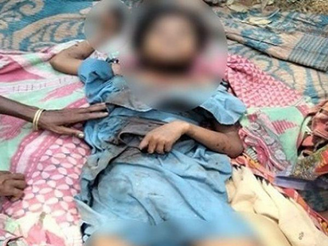 Phi thường - kỳ quặc - Thiếu nữ 14 tuổi qua đời khi tự làm đẹp tại nhà, cảnh báo tình huống nguy hiểm đến chị em phụ nữ