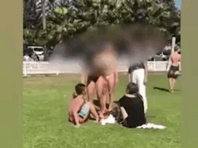 Phi thường - kỳ quặc - Cô gái diện bikini tắm nắng trên bãi cỏ, vô duyên vô cớ bị người khác hành hung điên cuồng