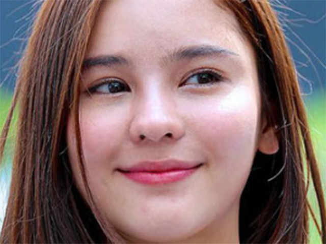 Làm đẹp - Vì sao các hoa khôi, hotgirl hiếm khi có mụn với sẹo thâm: Hóa ra là vì lý do này!