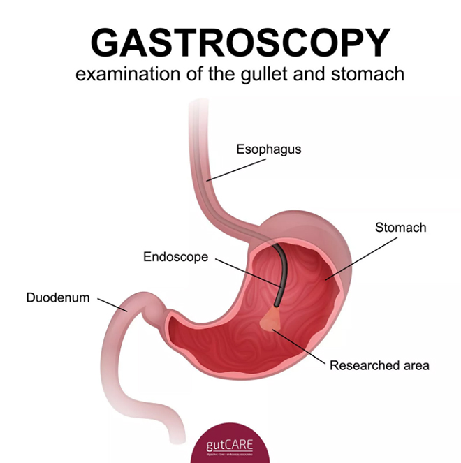 Chẩn đoán hình ảnh nâng cao - tầm soát ung thư chính xác hơn - 1