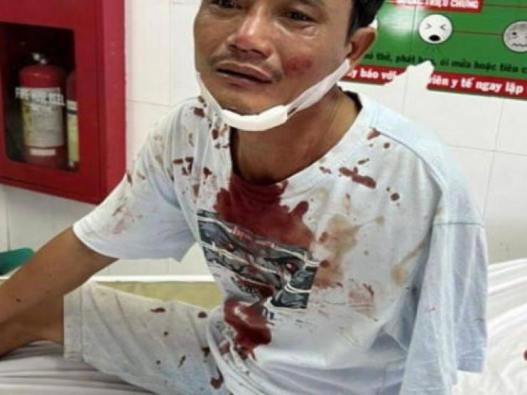 Pháp luật - Người tàn tật bị vợ chồng tài xế xe tải đánh nhập viện cấp cứu