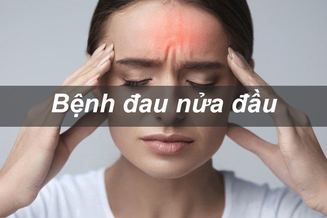 Bệnh đau nửa đầu rất phổ biến, tên gọi khác là đau đầu vận mạch hay Migraine