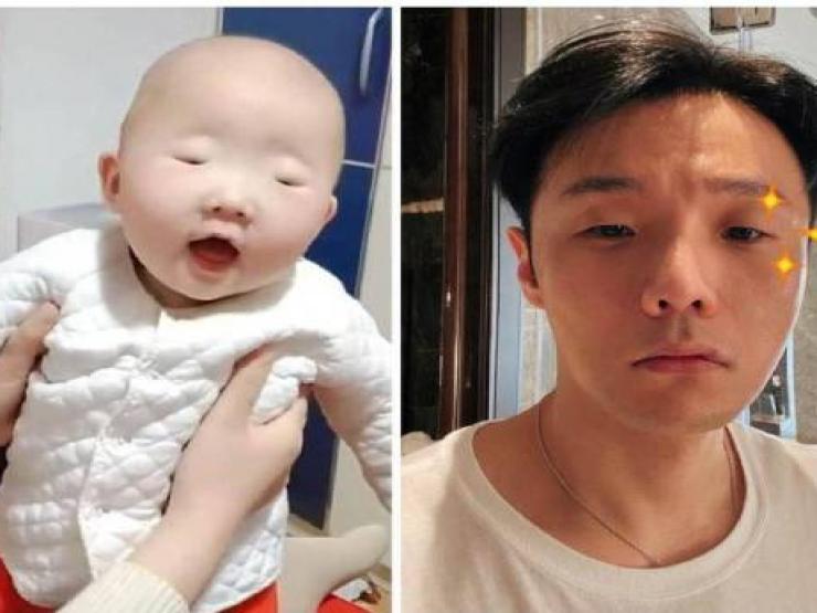 Bạn trẻ - Cuộc sống - Mẹ ăn nho để con có đôi mắt to đẹp, con chào đời khiến cả nhà dở khóc dở cười