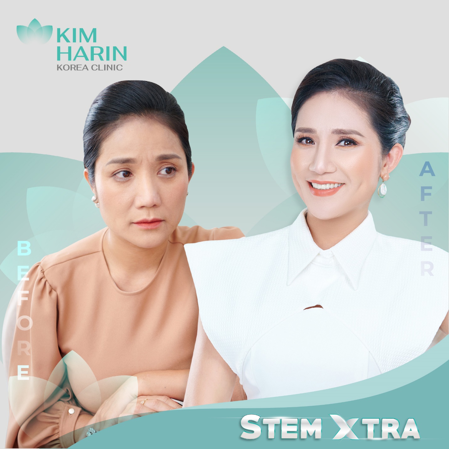 Hình ảnh trước – sau của nghệ sĩ Cát Tường