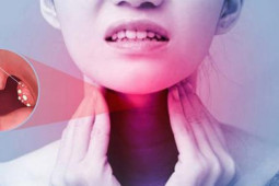 Sức khỏe đời sống - Ngứa họng gây ho, đừng chủ quan vì rất có thể bạn đang mắc bệnh nguy hiểm này